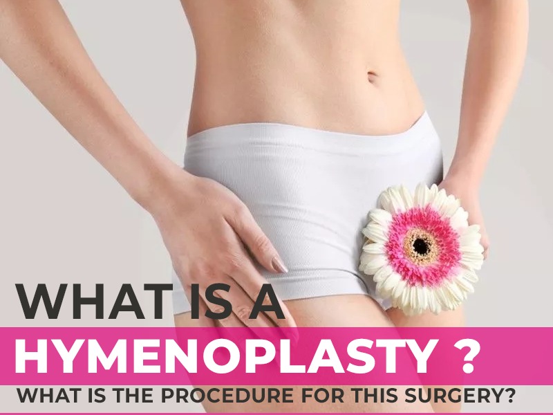 What is hymenoplasty? What is the procedure for this surgery?