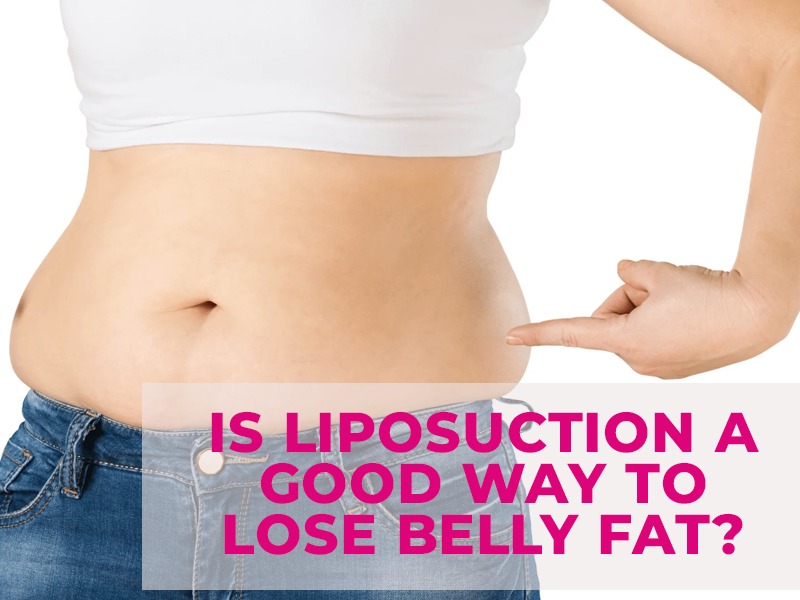 Is liposuction a good way to lose belly fat?